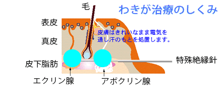 ���L�����Â̂����݃C���X�g